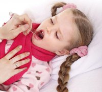 Лечение гнойной ангины у ребенка