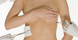 Подготовка к операции по увеличению груди
