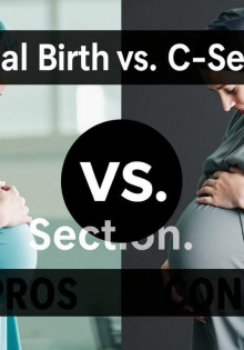 Natural Birth vs. C-Section: Pros and Cons
